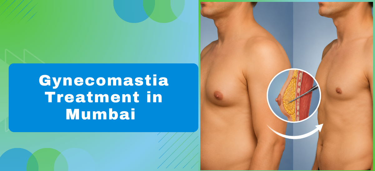 What Is Gynecomastia and How Can It Be Treated?