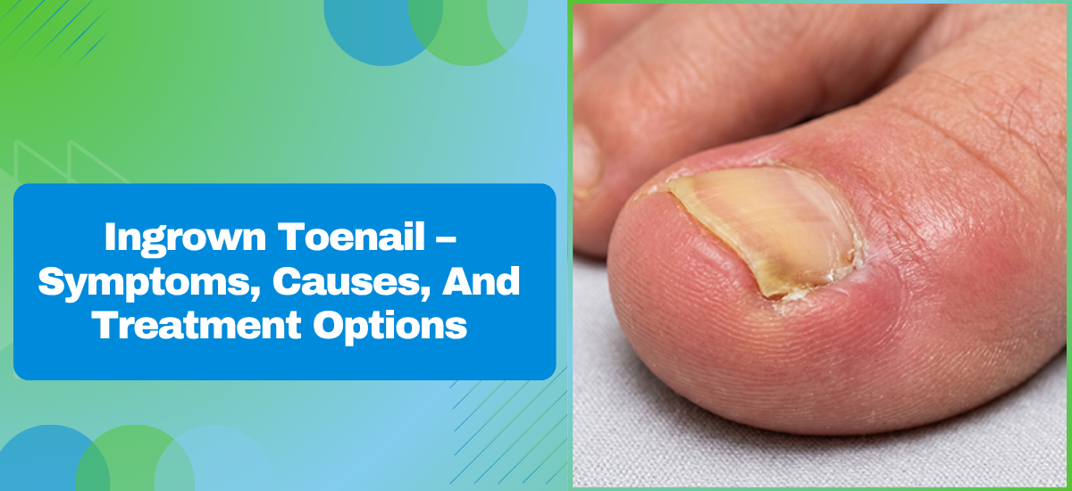 Ingrown Toenail – Symptoms, Causes, And Treatment Options