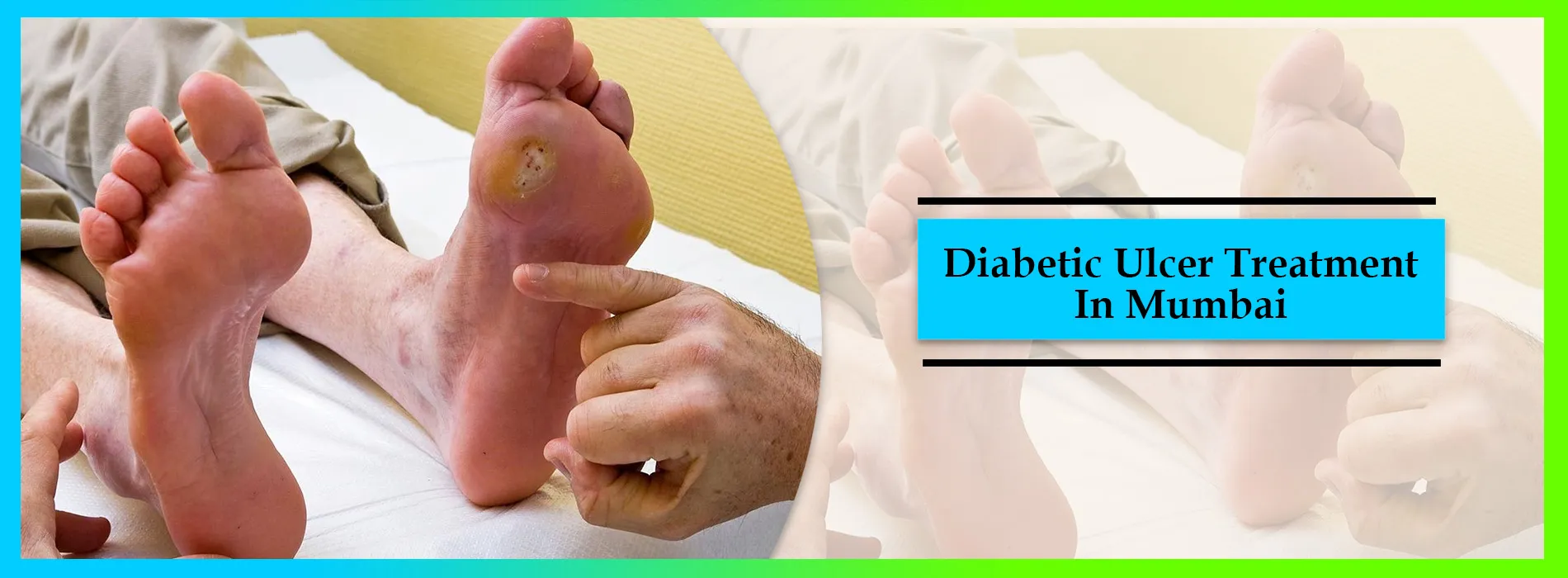 diabetic-ulcer-treatment-in-mumbai