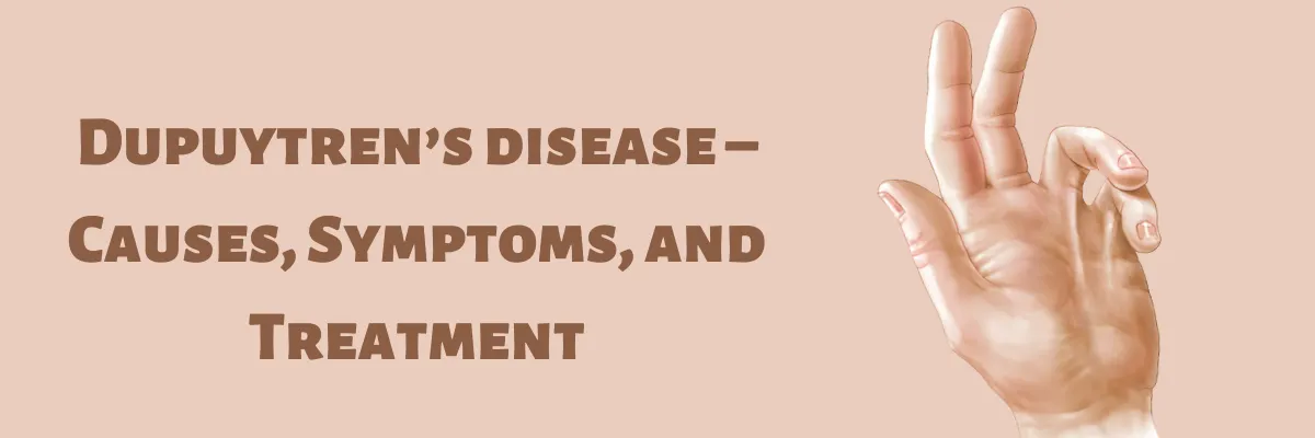 Dupuytren’s disease – Causes, Symptoms, and Treatment