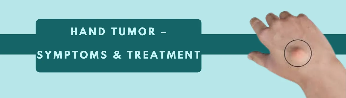 Understanding Hand Tumor: Types and Treatments