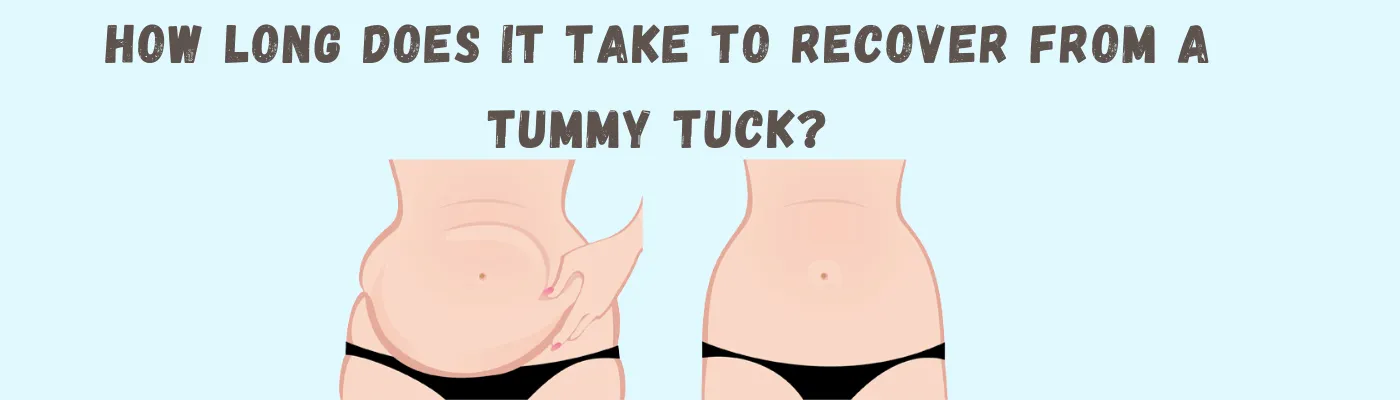 How long does it take to recover from a tummy tuck?