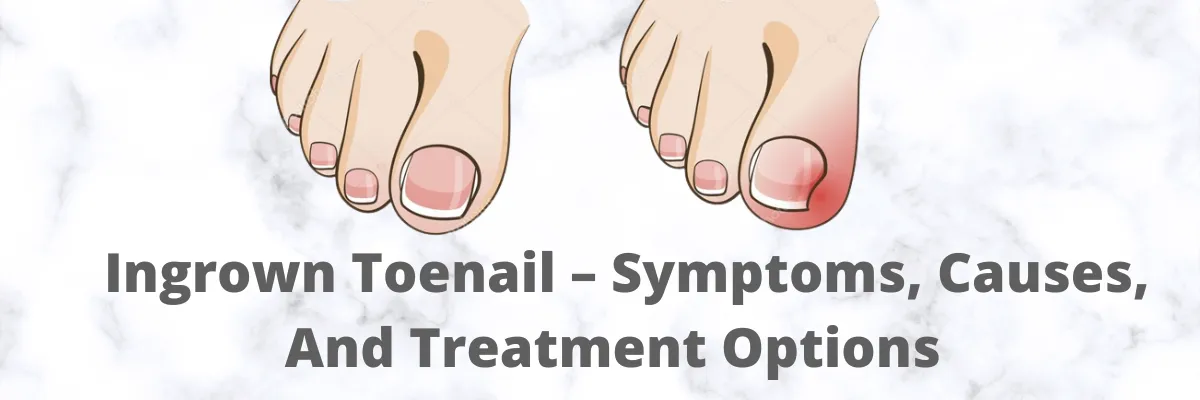 Ingrown Toenail – Symptoms, Causes, And Treatment Options