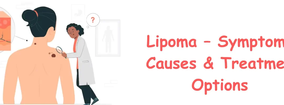 Lipoma – Symptoms, Causes & Treatment Options
