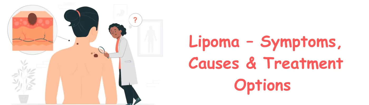 Lipoma – Symptoms, Causes & Treatment Options