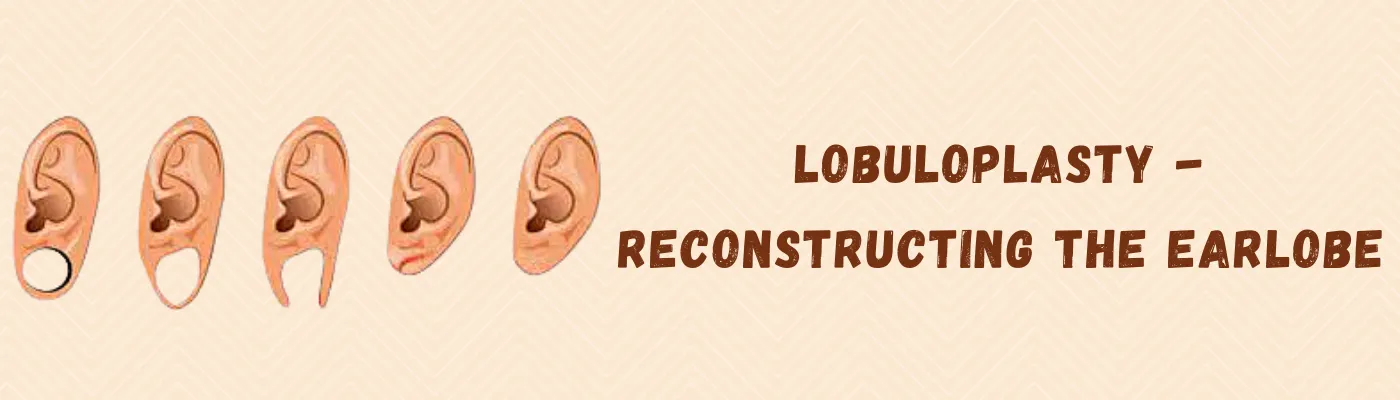 Lobuloplasty – Reconstructing The Earlobe