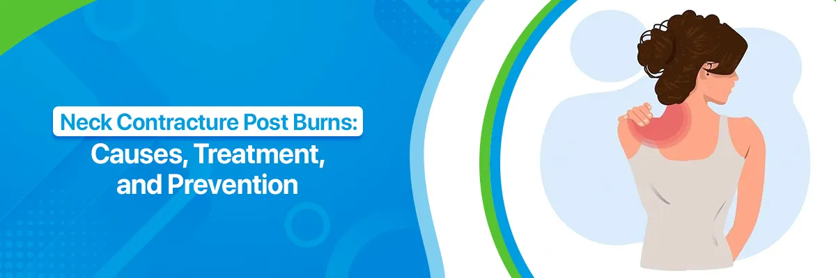 Neck Contracture Post Burns: Causes, Treatment, and Prevention