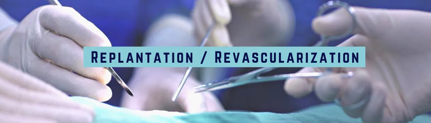 Replantation/Revascularization