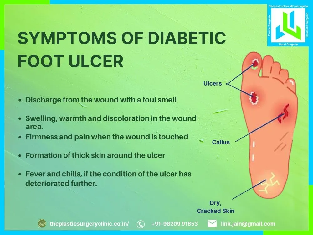 Symptoms of Diabetic foot ulcer