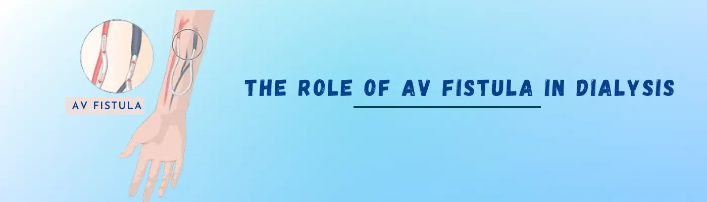 The Role Of AV fistula In Dialysis
