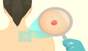 Risk of basal carcinoma | Dr. Leena Jain
