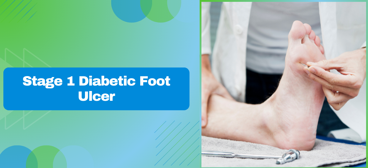 Stage 1 Diabetic Foot Ulcer