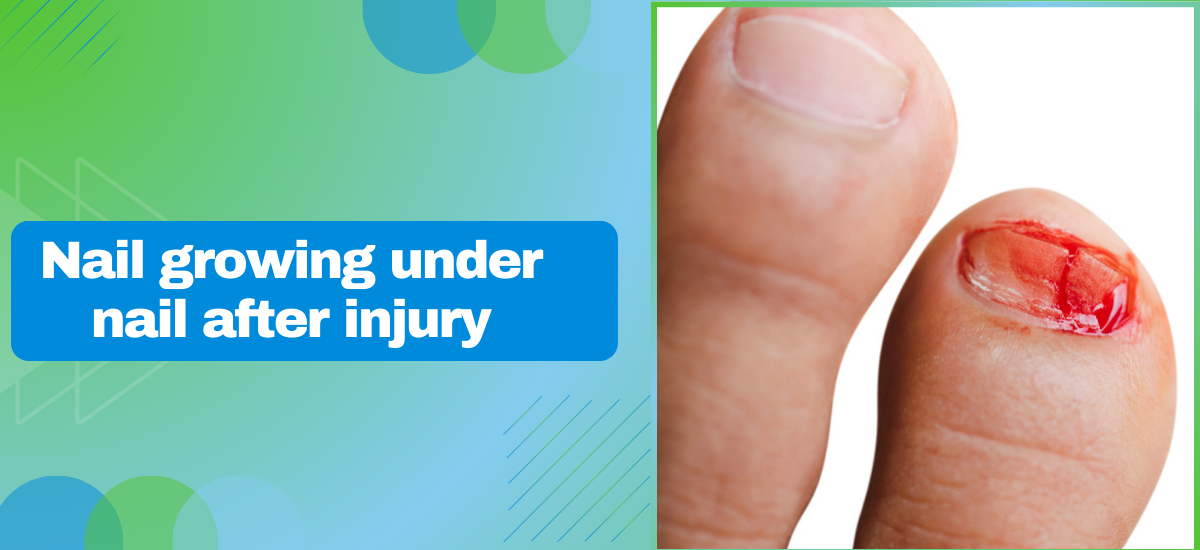 Nail Growing Under Nail After Injury