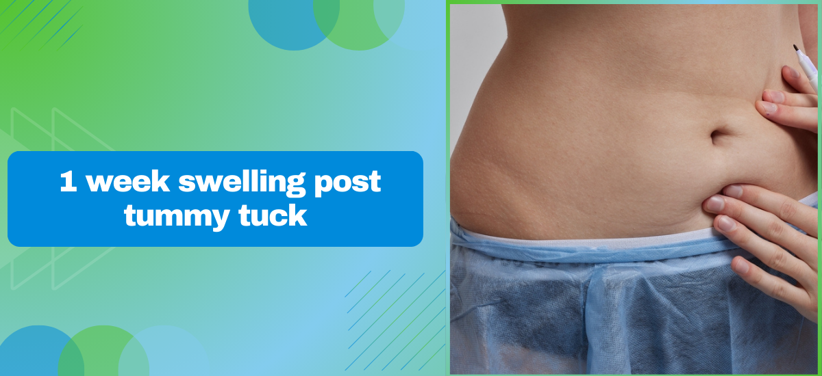 1 Week Swelling Post Tummy Tuck: Causes & Solutions