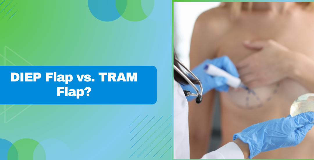 DIEP flap VS TRAM flap | Dr. Leena Jain