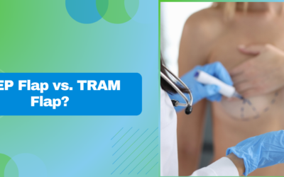 DIEP Flap vs. TRAM Flap: Which is Better for Breast Reconstruction
