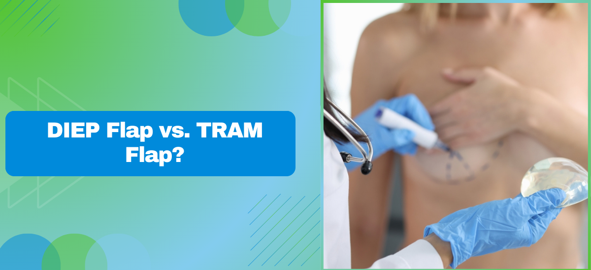 DIEP Flap vs. TRAM Flap: Which is Better for Breast Reconstruction
