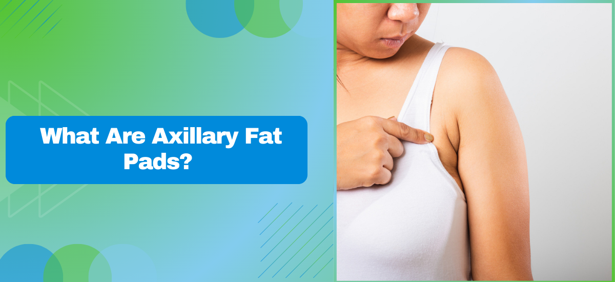 What Are Axillary Fat Pads? Causes and Treatment
