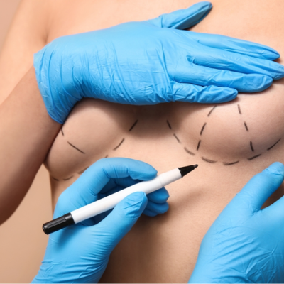 breast_surgery
