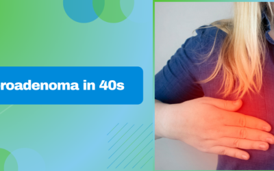 Fibroadenoma in 40s: Causes, Treatments, and Aesthetic Solutions