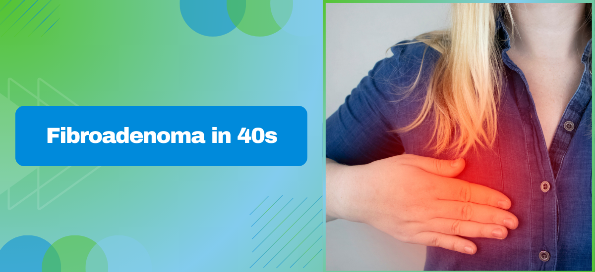 Fibroadenoma in 40s: Causes, Treatments, and Aesthetic Solutions