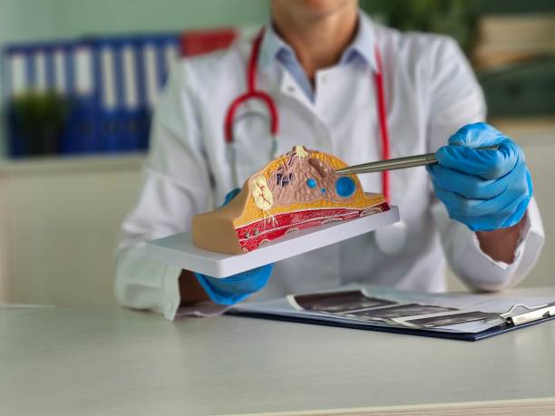 Why Fibroadenomas Can Appear or Change in Your 40s