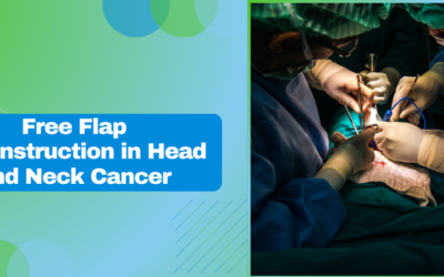 Understanding the Role of Free Flap Reconstruction in Head and Neck Cancer