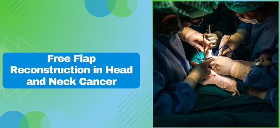 Understanding the Role of Free Flap Reconstruction in Head and Neck Cancer