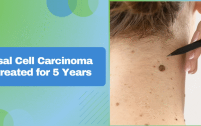 Basal Cell Carcinoma Untreated for 5 Years