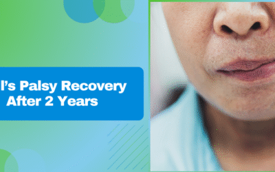 Bell’s Palsy Recovery After 2 Years