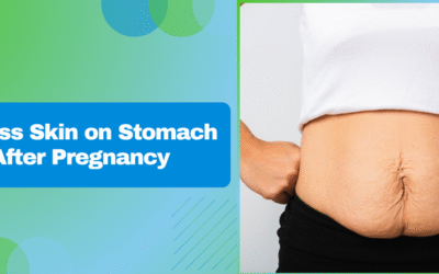 Excess Skin on Stomach After Pregnancy