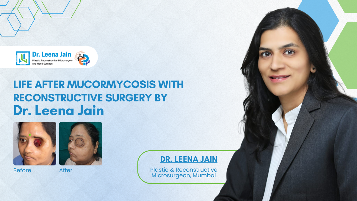 Advanced Facial Reconstruction Restores Life for Post-COVID Mucormycosis Survivor