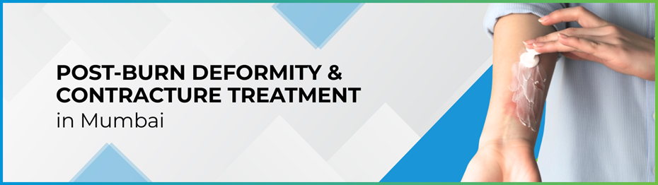 image Hand Surgery in Mumbai