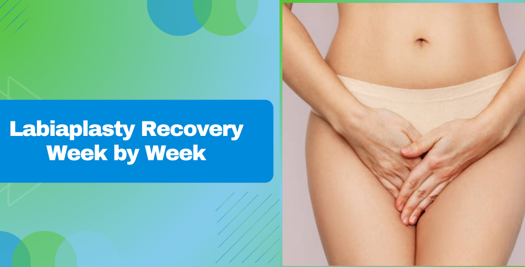Labiaplasty Recovery Week by Week