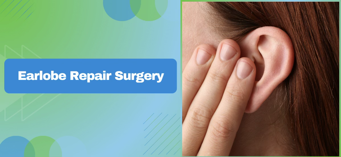 Earlobe Repair Surgery: Treatment for Split or Elongated Earlobes