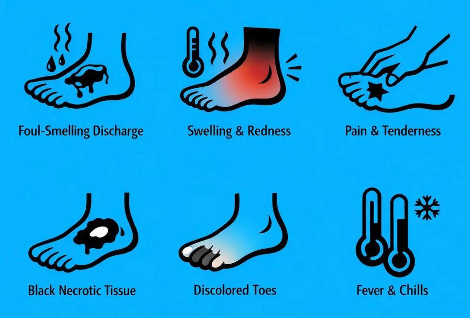 Diabetic Ulcer Treatment in Mumbai