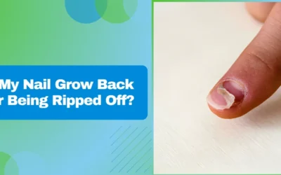 Will My Nail Grow Back After Being Ripped Off?