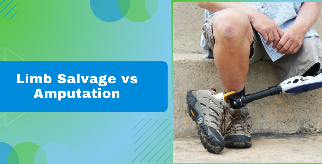 Limb Salvage vs Amputation