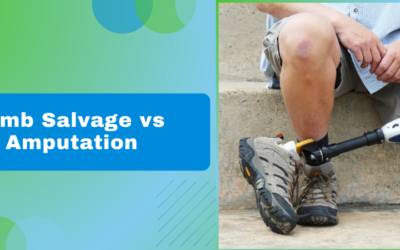 Limb Salvage vs Amputation: How Surgeons Decide and What It Means for You?