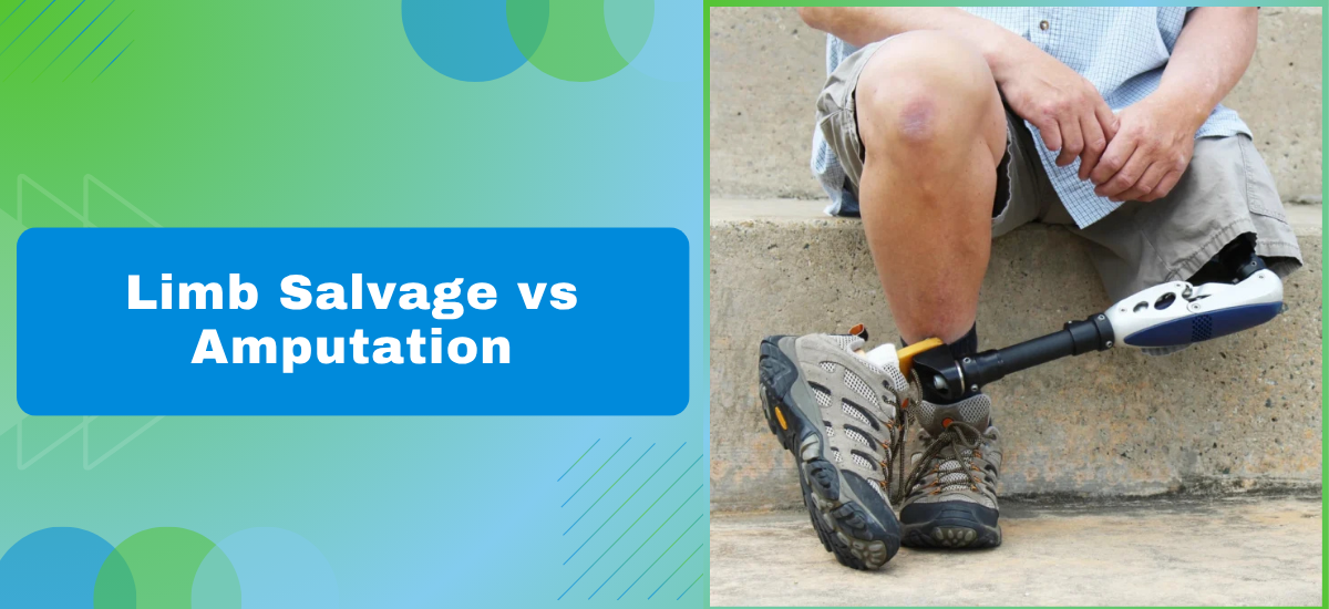 Limb Salvage vs Amputation