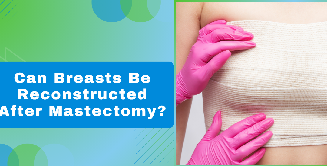 Can Breasts Be Reconstructed After Mastectomy