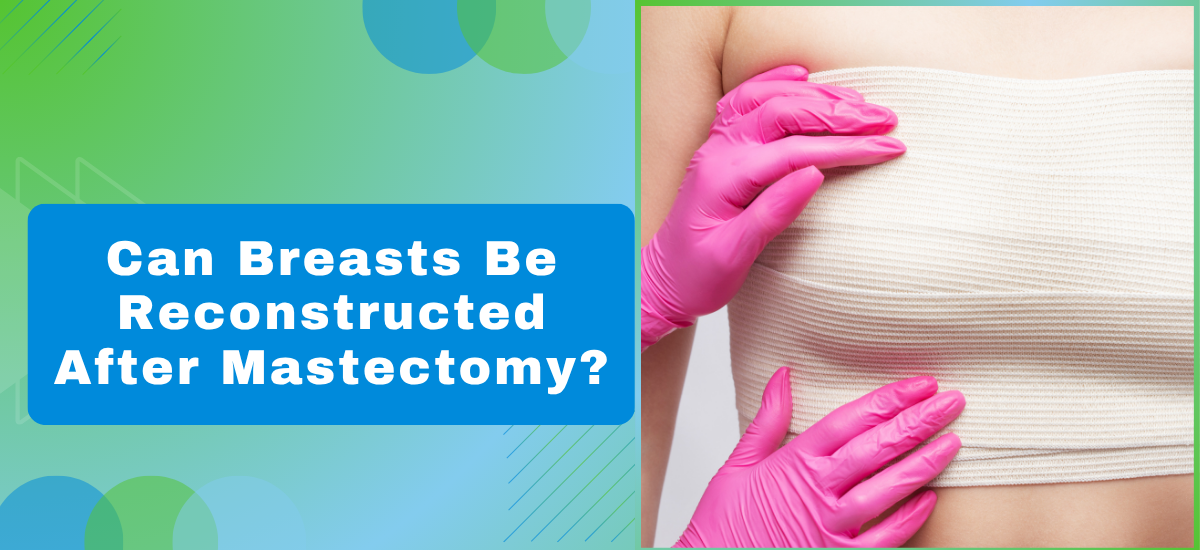 Can Breasts Be Reconstructed After Mastectomy?