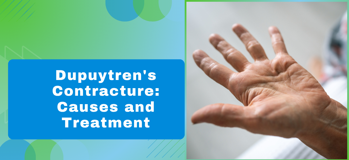 What Causes Dupuytren’s Contracture and How Is It Treated?