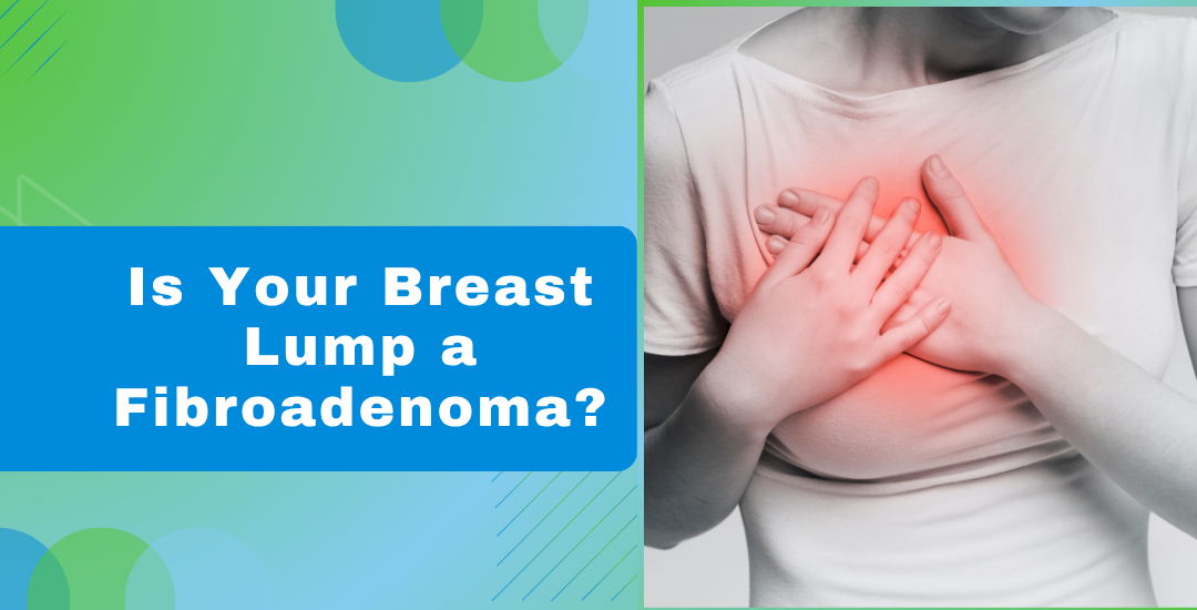 Is Your Breast Lump a Fibroadenoma