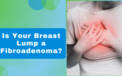Is Your Breast Lump a Fibroadenoma and When Should It Be Removed?