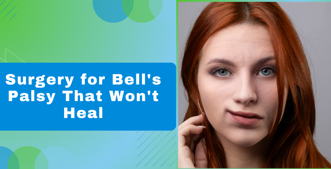 Surgery for Bells Palsy That Wont Heal