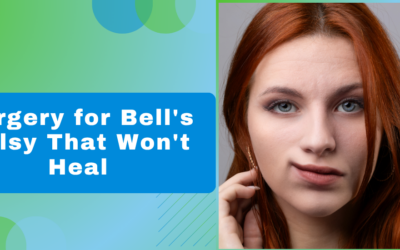 Can Surgery Fix Bell’s Palsy That Won’t Heal?