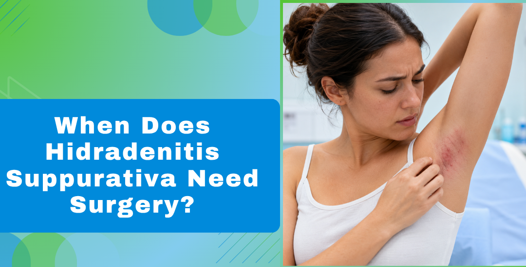 When Does Hidradenitis Suppurativa Need Surgery