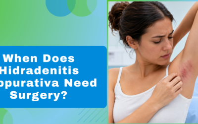 When Does Hidradenitis Suppurativa Need Surgery?