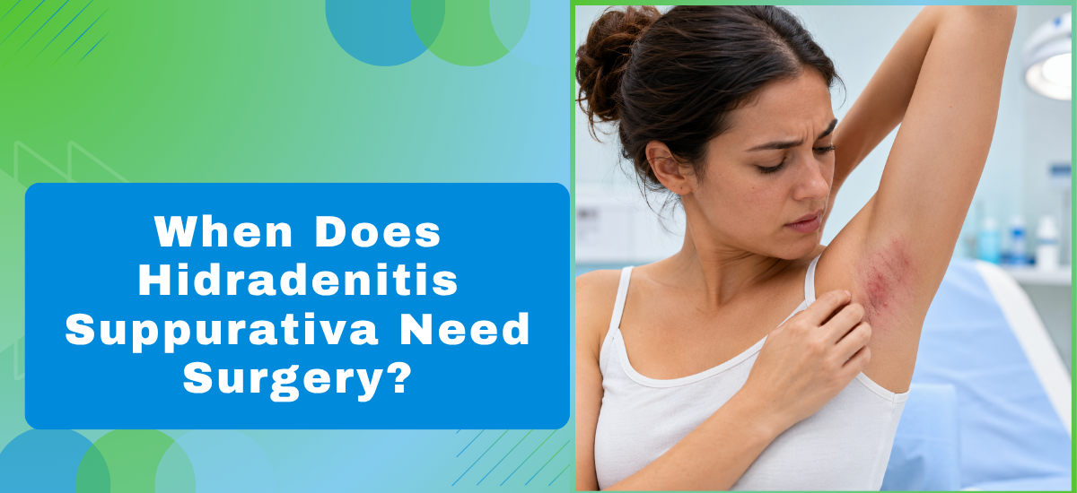 When Does Hidradenitis Suppurativa Need Surgery - Dr Leena Jain When Does Hidradenitis Suppurativa Need Surgery